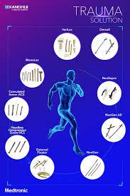 Diferentes tipos de placas para codo, hombro, mano, rodilla y tibia